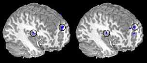 Functional magnetic resonance imaging shows activation of the same brain sites in cocaine addicts