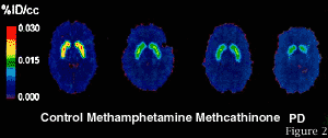 Methamphetamine Effects