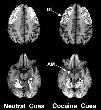 Brain scans - see caption