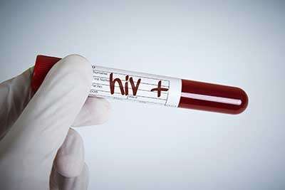A positive HIV test