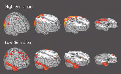 PET scans showing brain activity, described in caption