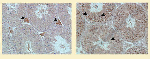This pair of micrographs shows cannabinoid receptors in mice testes cells. In the picture on the left, arrowheads point to cannabinoid 1 receptors, while in the picture on the right they point to cannabinoid 2 receptors.