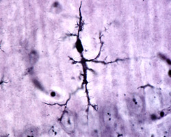 Microglia cell stained with Rio Hortega's silver carbonate method
