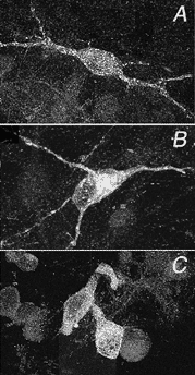 Nerve Cells With Substance P(SP) Receptors