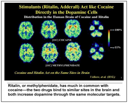 PET scans - titled Stimulants (Ritalin, Adderall) act like cocaine directly in the dopamine cells