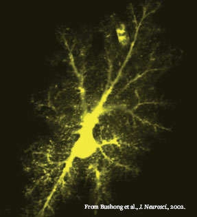 image of astrocyte from live rat brain