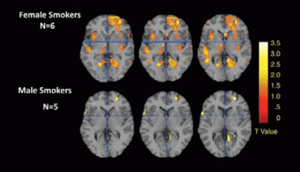 Functional magnetic resonance images show a cross-sectional view of three female and three male brains. The brains of the female smokers have substantially more white, yellow, and orange areas than those of males, indicating higher levels of activation after exposure to smoking cues.