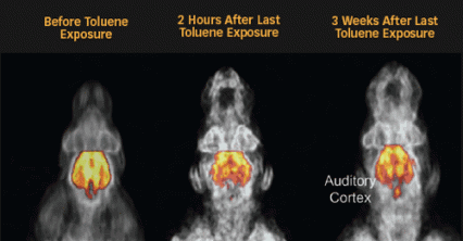 PET images of toluene exposure effets on rat brain activity - see caption