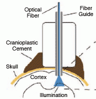 Illustration of how the optical fiber is routed through the skull and into the brain.