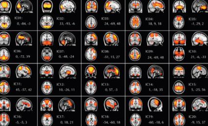A set of 20 scans shows distinct brain networks that are active during the resting state. Three views (from the back and side of the skull and in cross-section) are presented for each scan.