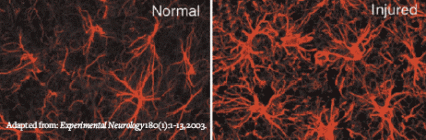 microscopic image of normal and injured astrocyte proliferation.  Much higher density is shown in the injured image.