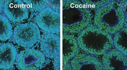 Cocaine triggers heritable, epigenetic marks on key developmental gene in the sperm of exposed male rats 