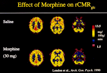 Brain effects of Morphine